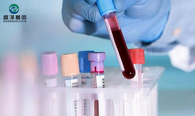 做親子鑒定父母都要驗(yàn)血嗎？鑒定親子關(guān)系流程有哪些？