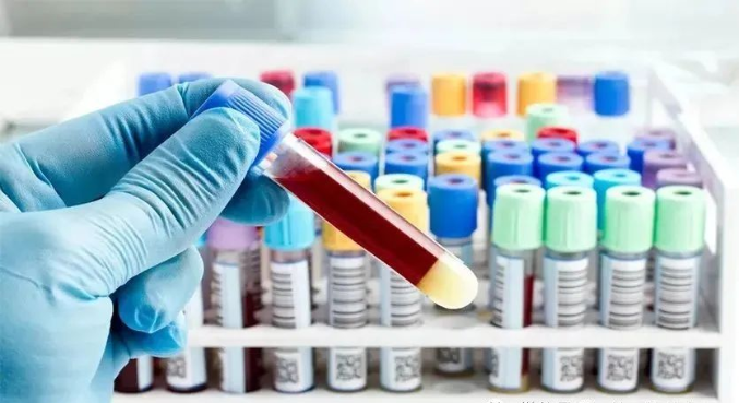 親子鑒定樣本放了一段時間還能用嗎？