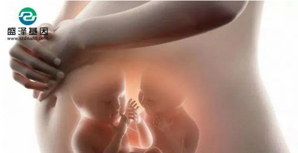 醫學怪病奇美拉現象:親自生未必是親生?你身體還住著另一個人? 醫學怪病奇美拉現象:親自生未必是親生?你身體還住著另一個人?