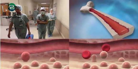 醫學怪病奇美拉現象:親自生未必是親生?你身體還住著另一個人? 醫學怪病奇美拉現象:親自生未必是親生?你身體還住著另一個人?