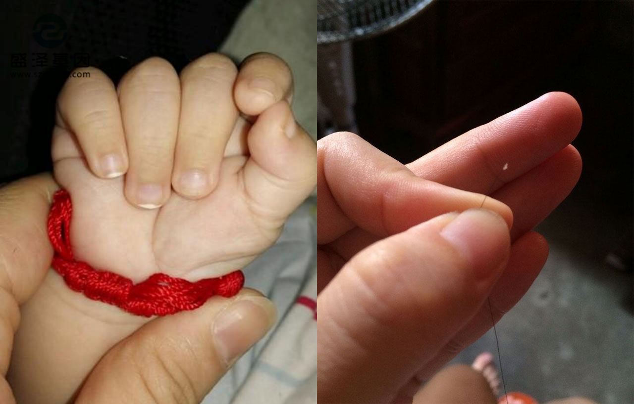 親子鑒定樣本怎么采集?采集頭發 親子鑒定樣本怎么采集?采集頭發