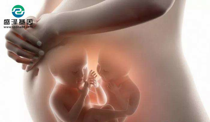 雙胞胎越長越不像，寶爸決定做親子鑒定！