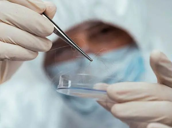 隨便拔下一根帶毛囊的毛發可以做親子鑒定樣本嗎？