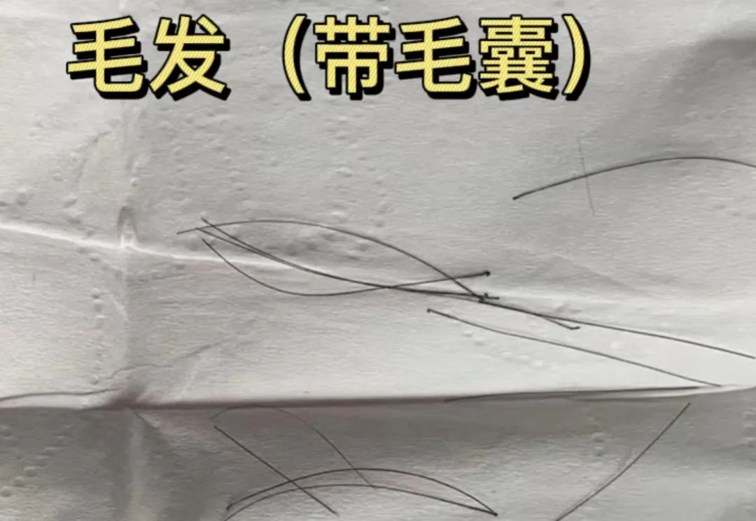 親子鑒定樣本采集棉棒上的血痕可以嗎? 親子鑒定樣本采集棉棒上的血痕可以嗎?