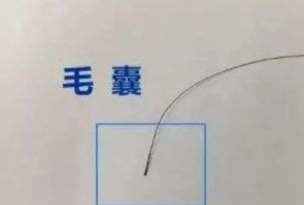 什么是親子判定?小梅與陳姑娘的故事 什么是親子判定?小梅與陳姑娘的故事