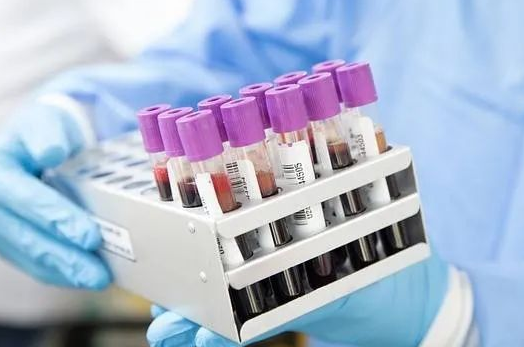 胎兒還沒有生下來能不能做親子鑒定采集羊水? 胎兒還沒有生下來能不能做親子鑒定采集羊水?