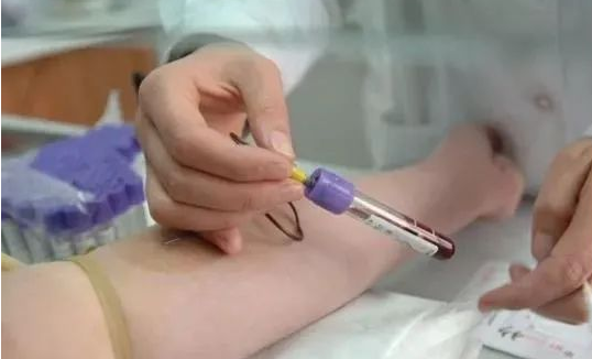 無創胎兒親子鑒定抽血需要孕婦空腹嗎？