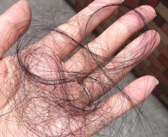 掉落的毛囊毛發可以拿去做染色體親子鑒定嗎？