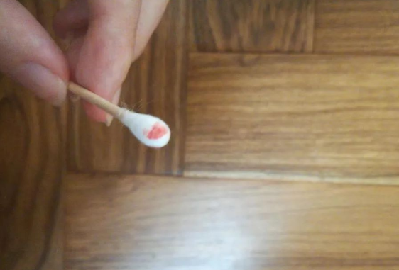 煙頭、血痕、毛發(fā)，做親子鑒定用哪些樣本最為準(zhǔn)確？