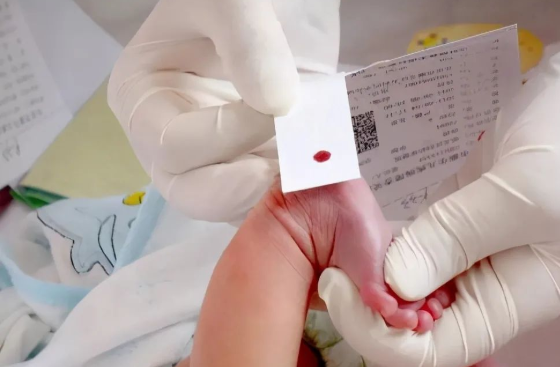 孩子出生前與出生后做親子鑒定檢測(cè)堿基有什么不同? 孩子出生前與出生后做親子鑒定檢測(cè)堿基有什么不同?