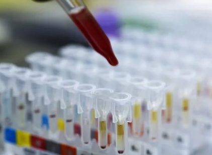 探秘個人親子鑒定和司法親子鑒定，什么是兩聯體、三聯體？