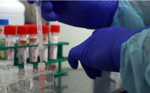 為您細數男方女方做親子鑒定的各種原因，包括：撫養費和第三者...