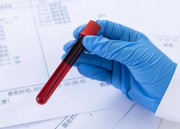 兄妹之間可以做親子鑒定嗎？兄弟之間可以做親緣關(guān)系鑒定嗎？