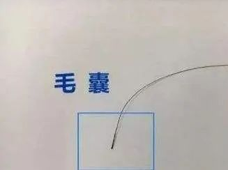 毛發可以做親子鑒定檢材嗎,怎么采集樣本才可以? 毛發可以做親子鑒定檢材嗎,怎么采集樣本才可以?