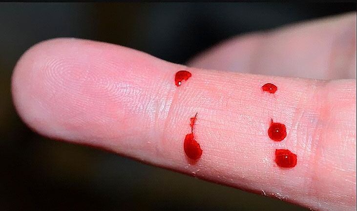 在中山如何做親子鑒定是最準確最簡單的？